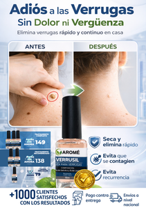 VERRUSIL- LACA ELIMINADORA DE VERRUGAS