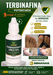 TERBINAFINA REPOTENCIADA (8% + UREA 10%) V