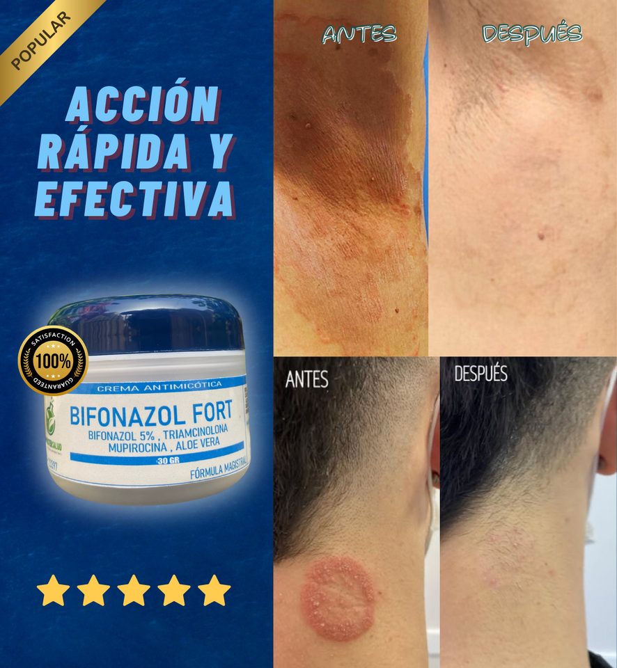 BIFONAZOL FORT ELIMINA LAS INFECCIONES EN LA PIEL